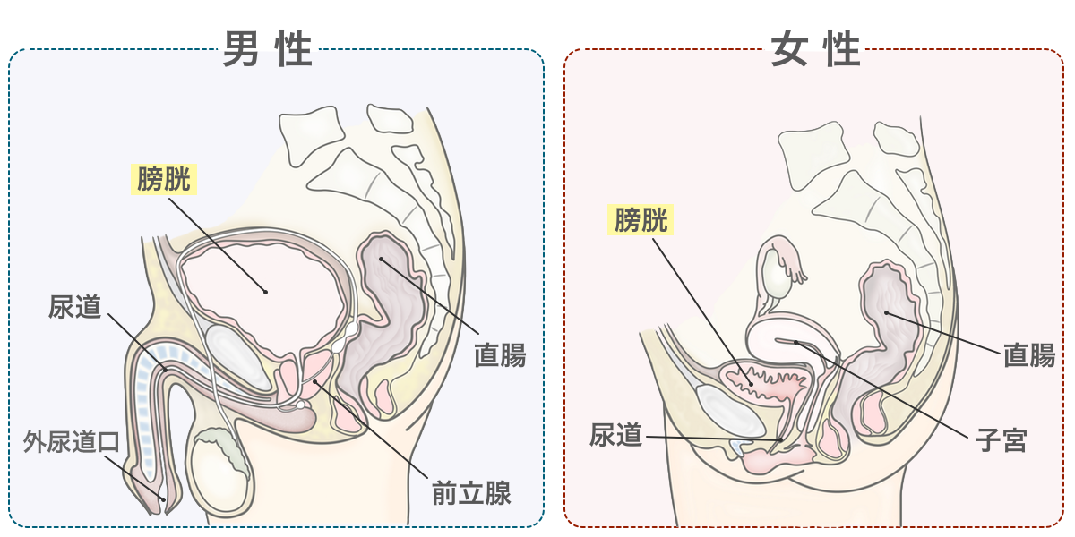 医師監修・作成］血尿の原因は膀胱結石？膀胱結石の症状、治療とは？ | MEDLEY(メドレー)