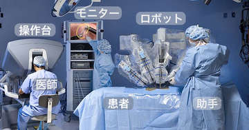 前立腺がんのロボット手術と開腹手術はどっちがいい？の写真