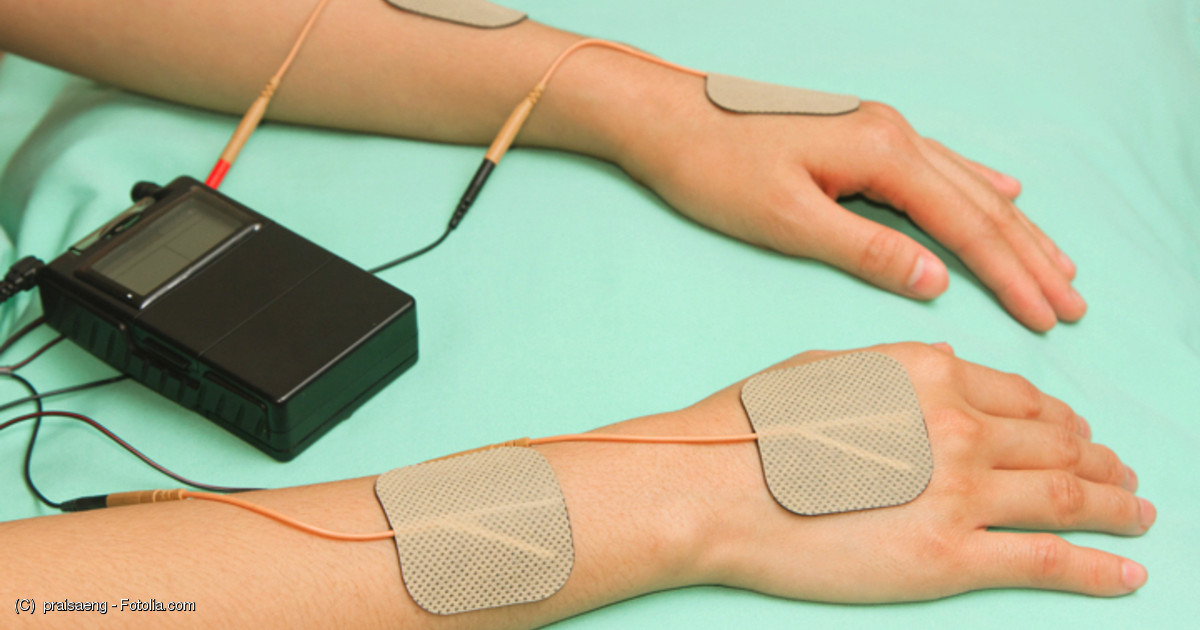 脳卒中で麻痺した手の機能が、ツボに電気刺激を行うと改善する MEDLEYニュース