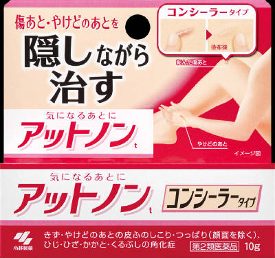 アットノンtの写真